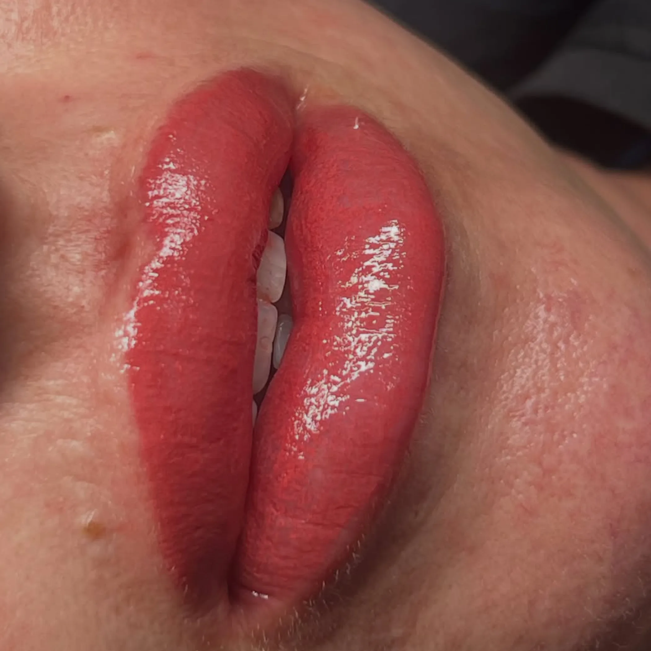 freshly tattooed lips during healing