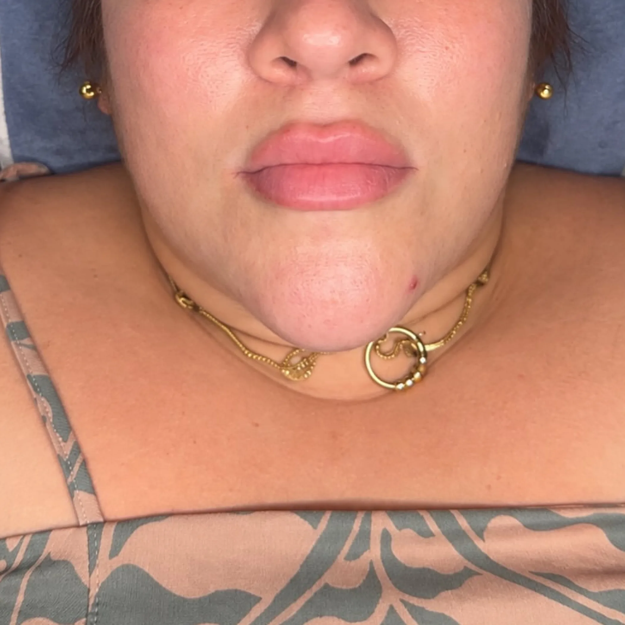 lip micropigmentation results